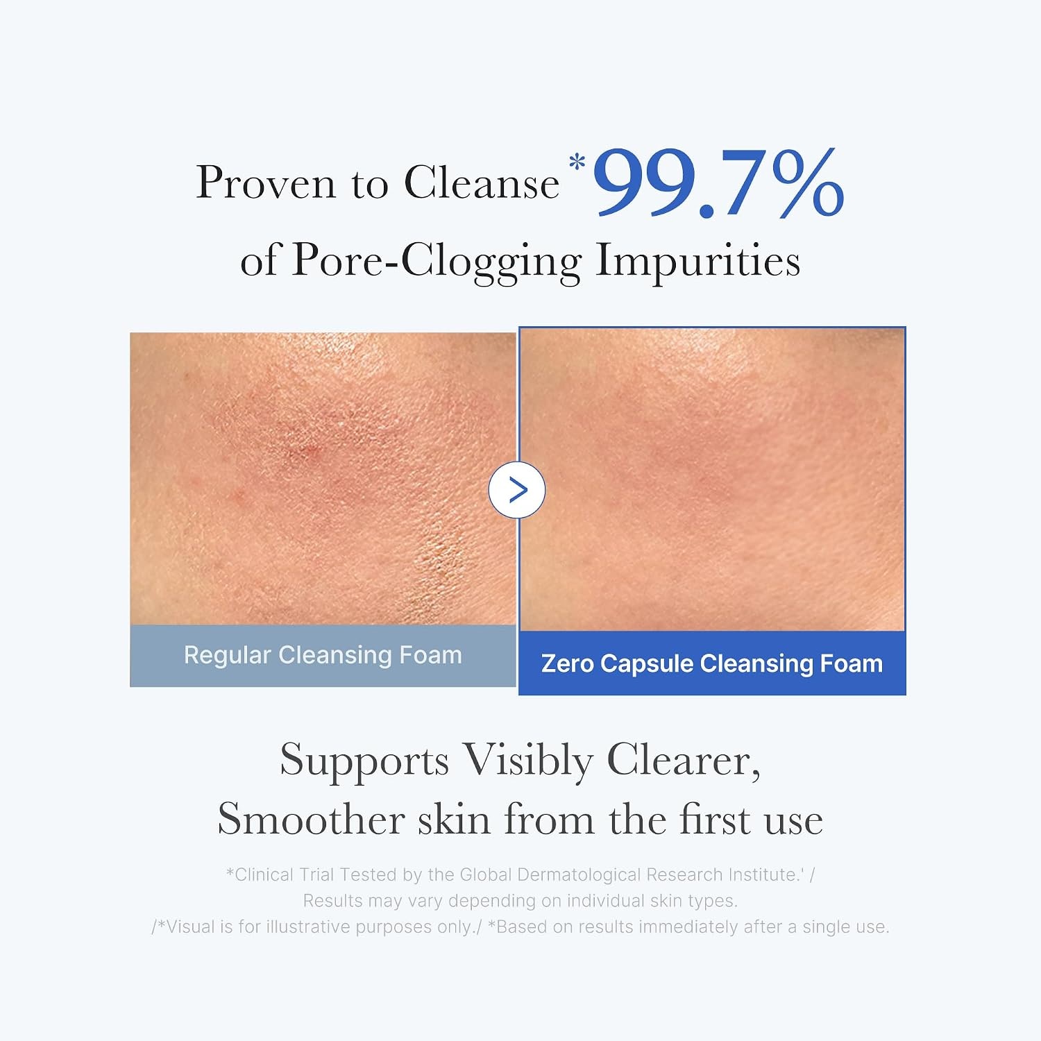 image:imagemedicube Facial Cleanser Azelaic Acid Capsule Foam Cleanser Pack of 2423 Ounce