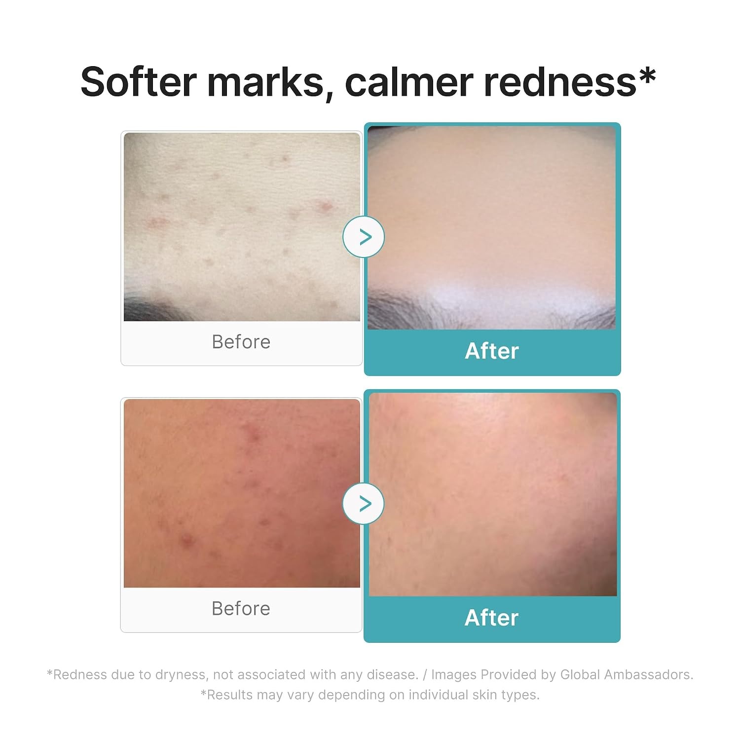image:imagemedicube Firm amp Soothe Serum Duo NAD Firming Serum amp Azelaic Acid Soothing Serum Korean Skincare