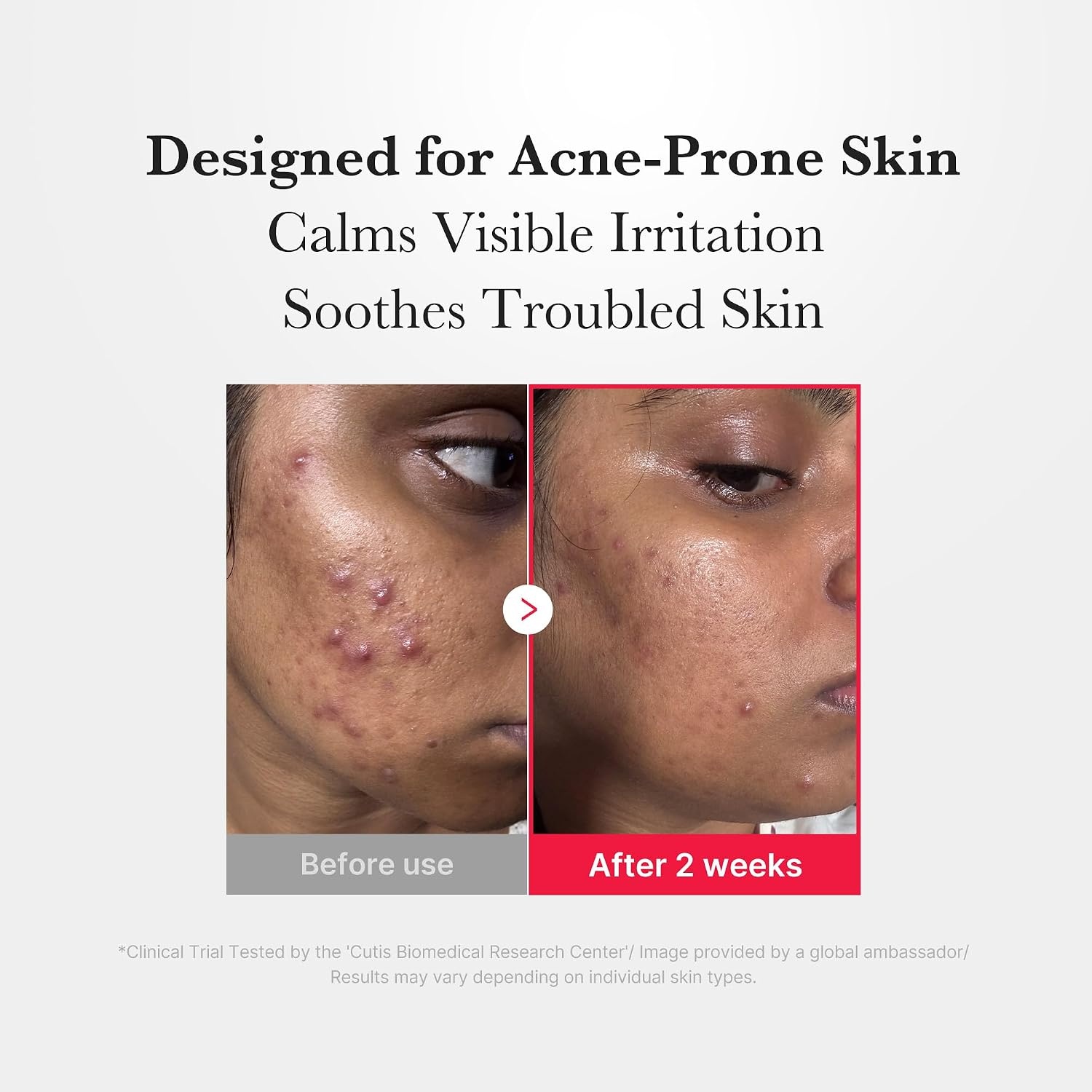 image:imagemedicube Swipe amp Spray Red Duo Red Succinic Pad amp Power Soothing Spray