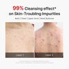 medicube Clear Body Essentials Duo: Red Body Wash and HOCI Body Peel Shot