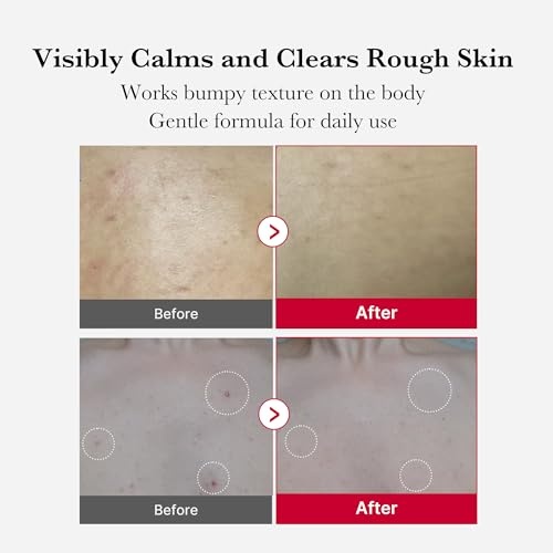 image:imagemedicube Red body glow essentials Red Body Wash and Body Peeling Shot